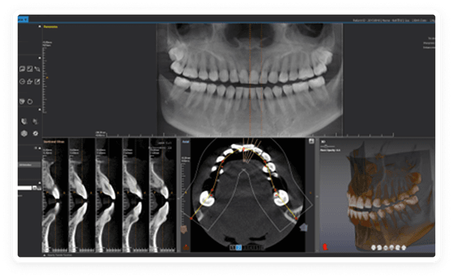 Panoramic (Arch curve)