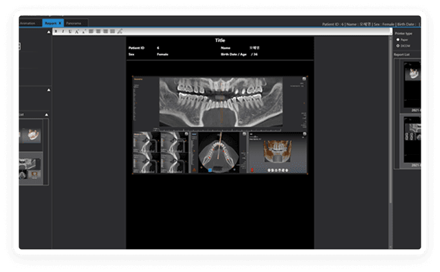 Report (DICOM Printing)