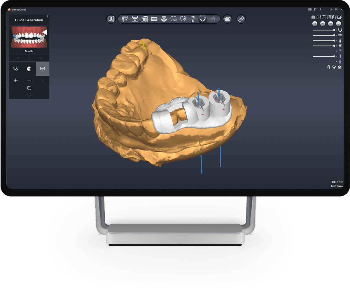 DentiqGuide Interface