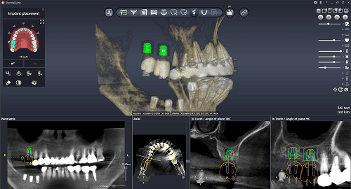 Panoramic Reconstruction