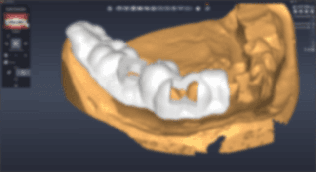 Guide Area Selection & Generation