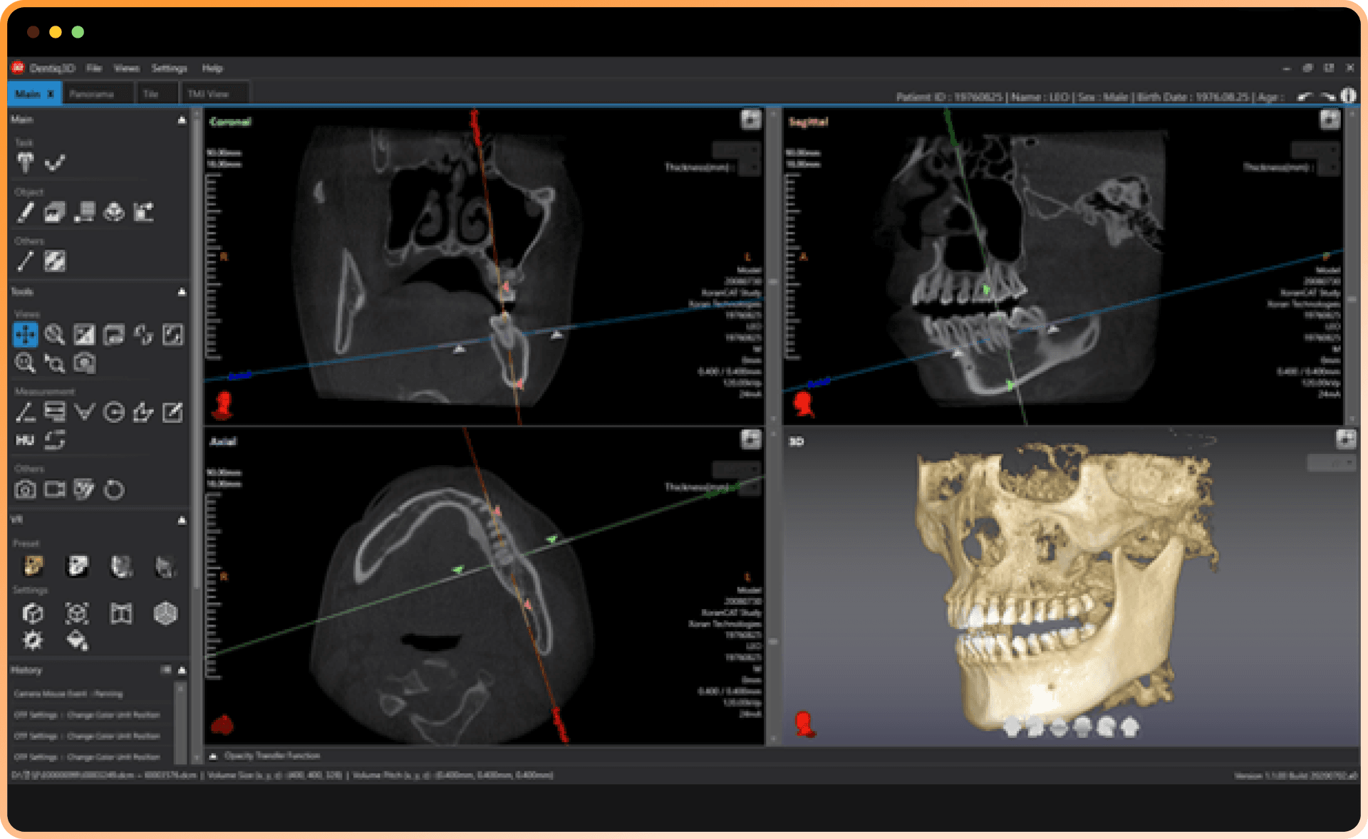 Dentiq3D Software Interface